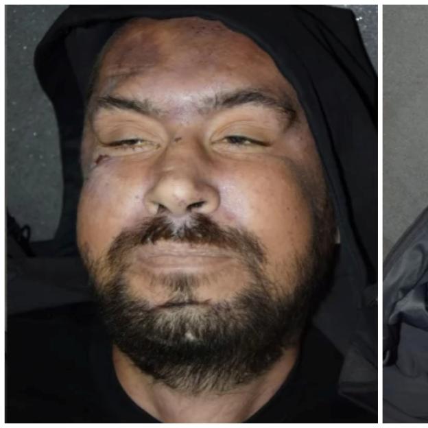 Tajemnicza śmierć w Zgierzu: Policja prosi o pomoc w identyfikacji mężczyzny